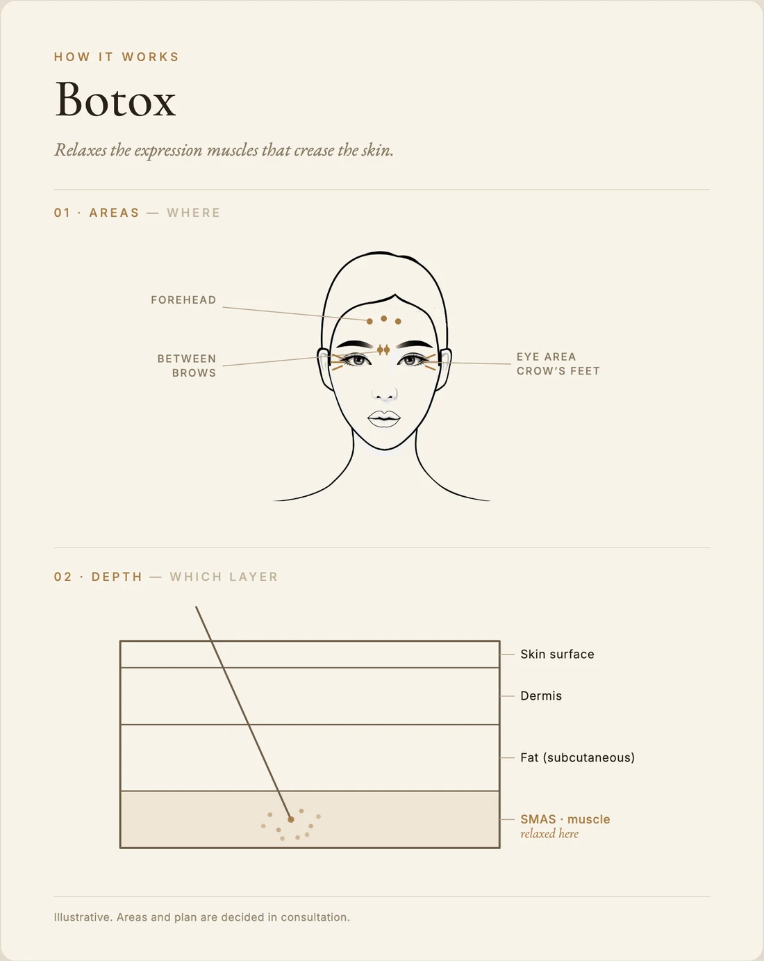Botox — how it works